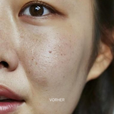 Set for Sensitive & Dry Skin