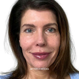 Intense Firming & Expression Face Cream