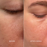 Prebiotic Skin Recharge Treatment