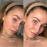 Prebiotic Skin Recharge Treatment