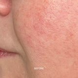 Prebiotic Skin Recharge Treatment