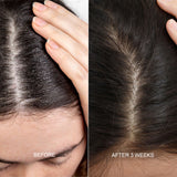 Scalp & Hair Detox Mask